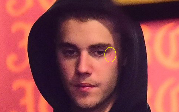 Justin Bieber'İn yüzündeki  dövme belli olmuyor